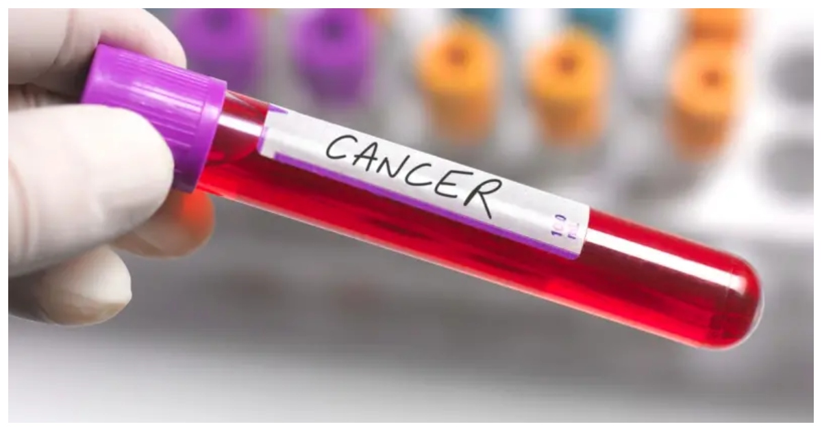 এই পরীক্ষার নাম দেওয়া হয়েছে 'গ্যালারি' টেস্ট। ছবি: গেটি ইমেজ